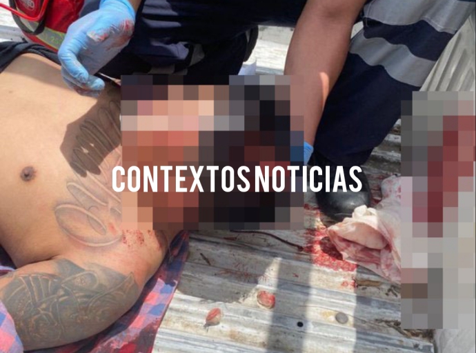 Bajo los influjos de una droga sujeto agrede a lugareños de Atlixco 