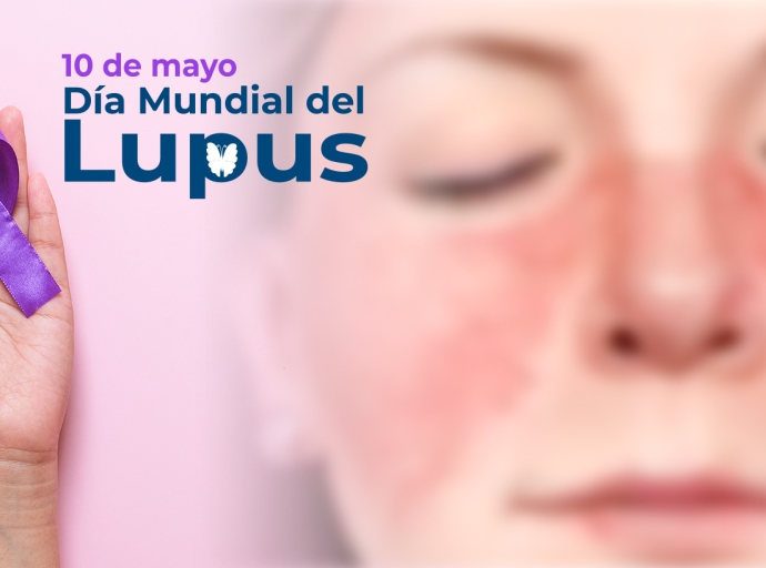 En Atlixco crean conciencia sobre el lupus con diferentes actividades ¡Participa! 