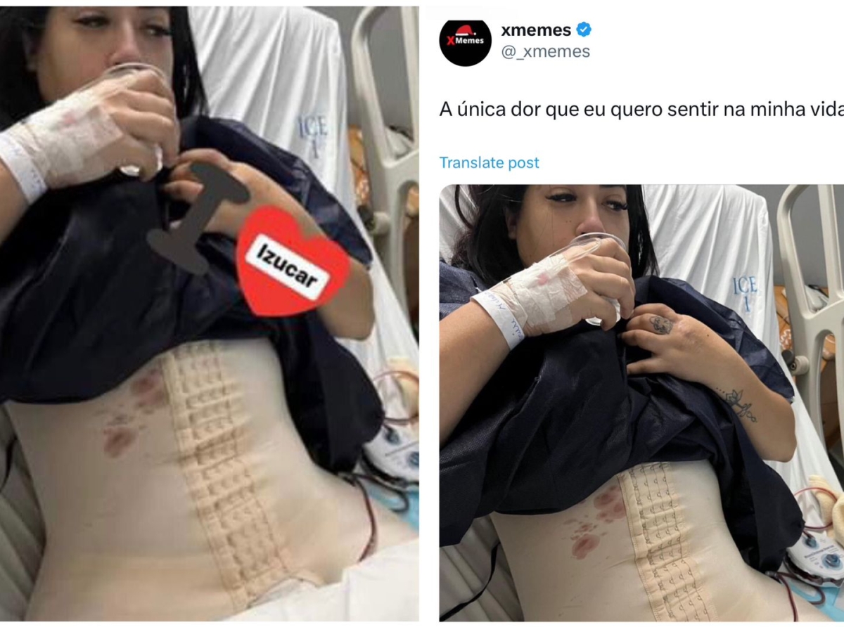 Falso que esta foto sea de la edil Irene Olea luego de una operación estética