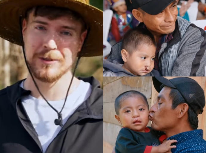 El youtuber MrBeast cambia vidas en Puebla con 100 cirugías para niños con labio leporino