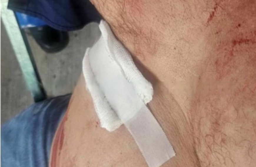 Por defender las limosnas termina macheteado