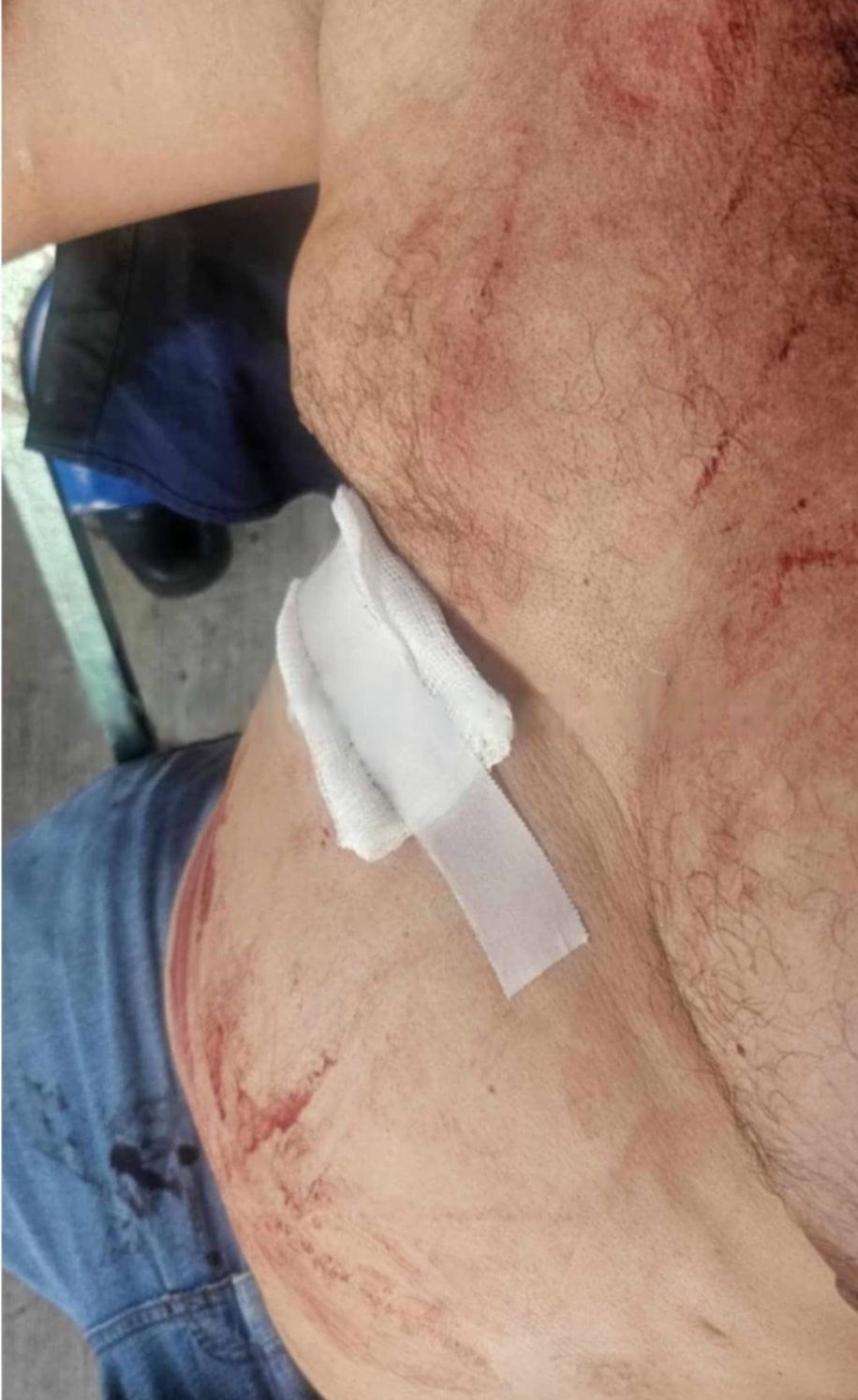 Por defender las limosnas termina macheteado
